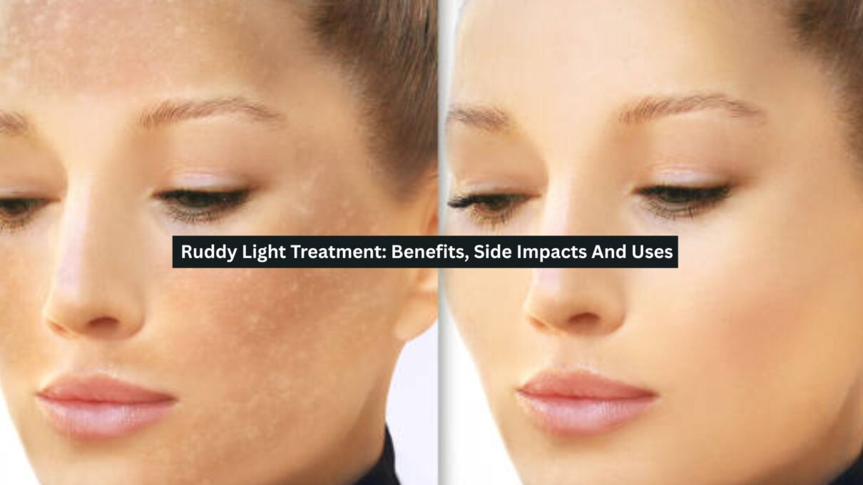 Ruddy Light Treatment