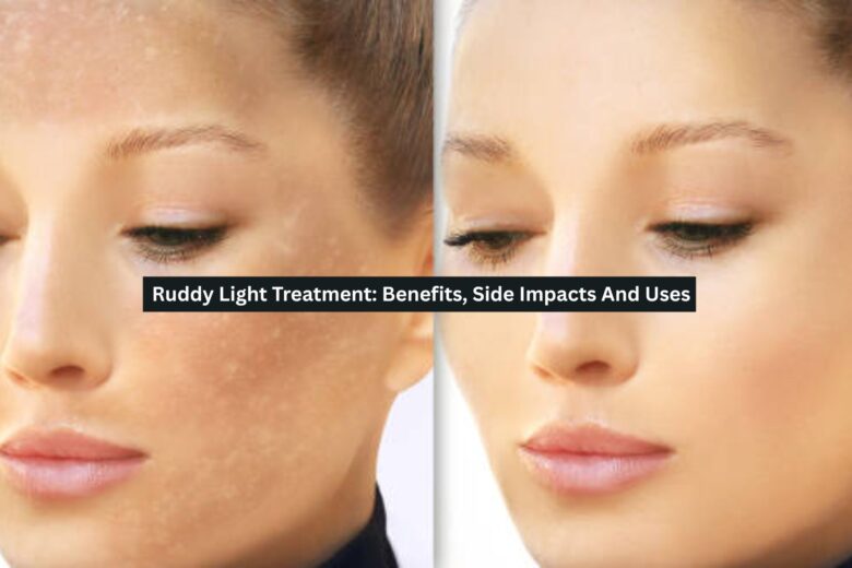 Ruddy Light Treatment